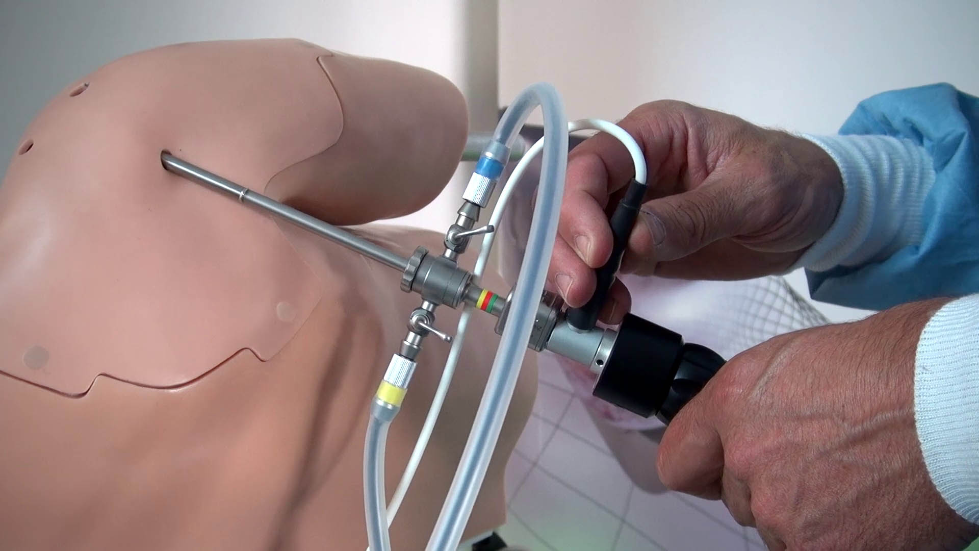 артроскопия