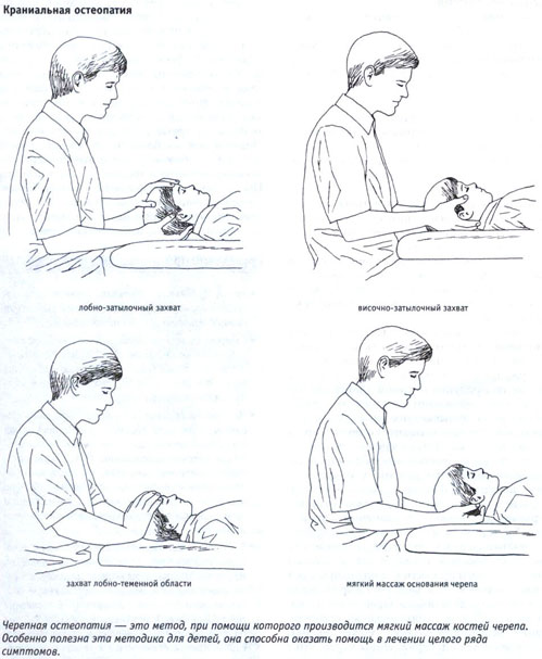 Краниальная остеопатия Краниальная остеопатия