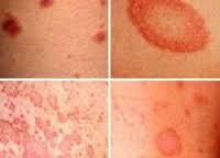 lishaj1.jpg lishaj1.jpg