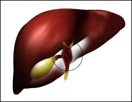 желчный пузырь